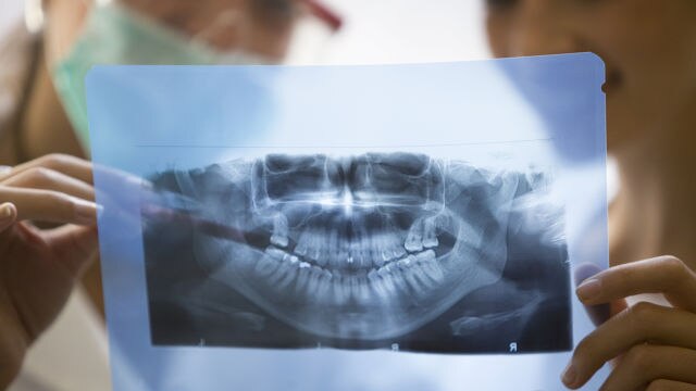 Dentiste montrant une radiographie à un patient